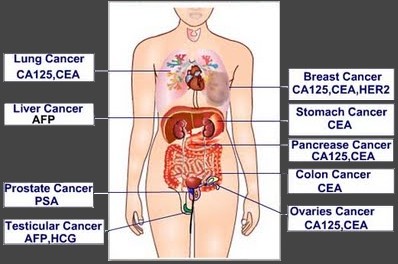 ماهو تحليل Tumor Markers؟
