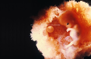 Thai nhi 16 tuần tuổi