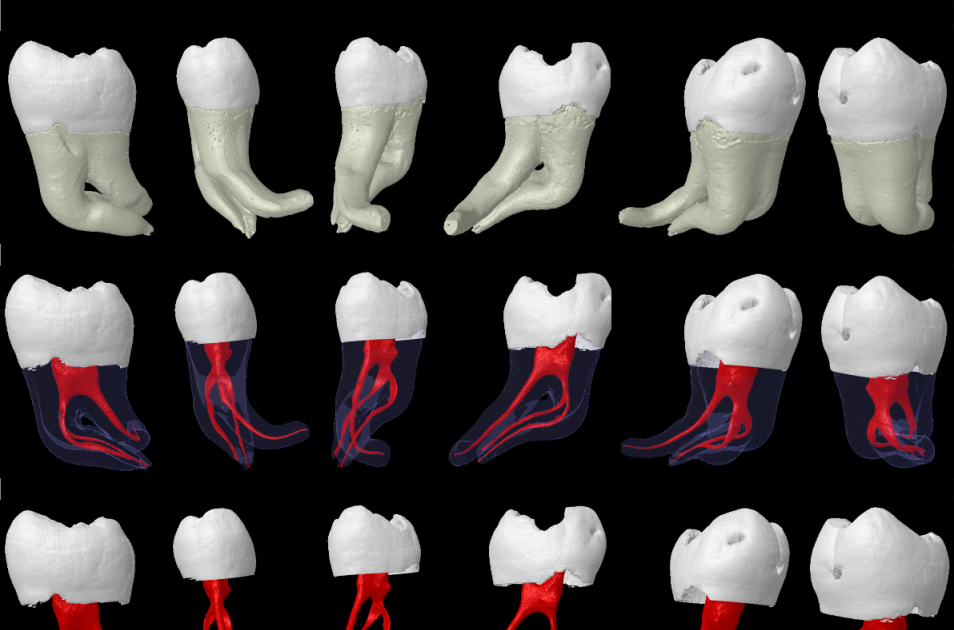 Nerve Pain: April 2015