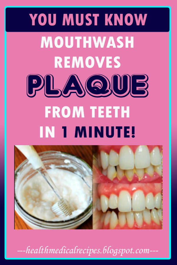 Mouthwash Removes Plaque From Teeth In 1 Minute