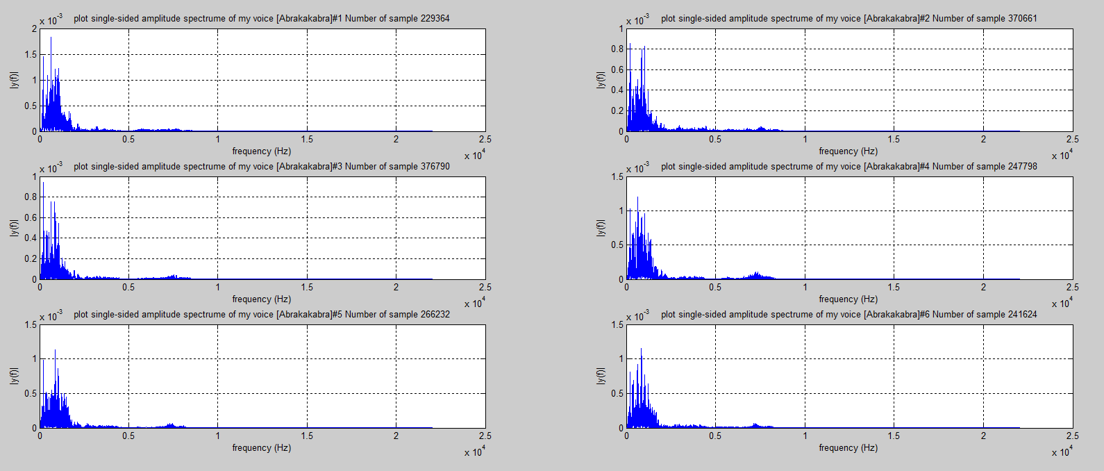 Biomedical Signal and Image Processing projects using Matlab and