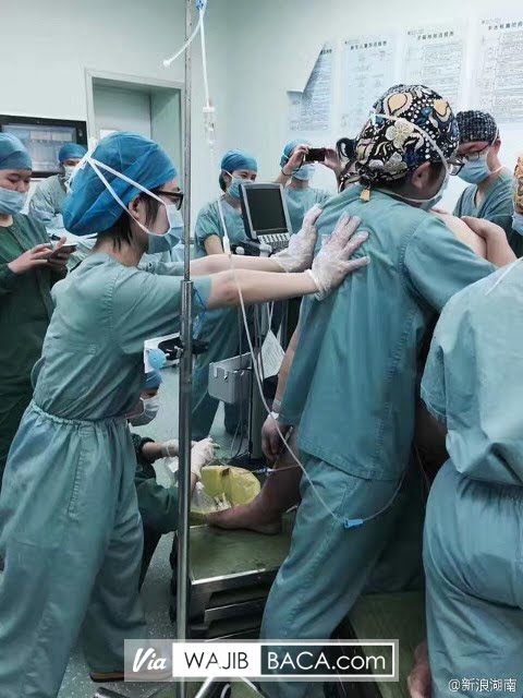 Astaga!, Dibutuhkan 16 Dokter Untuk Bantu Wanita Ini Melahirkan Karena Wanita Ini Memiliki... Astaga!, Dibutuhkan 16 Dokter Untuk Bantu Wanita Ini Melahirkan Karena Wanita Ini Memiliki...