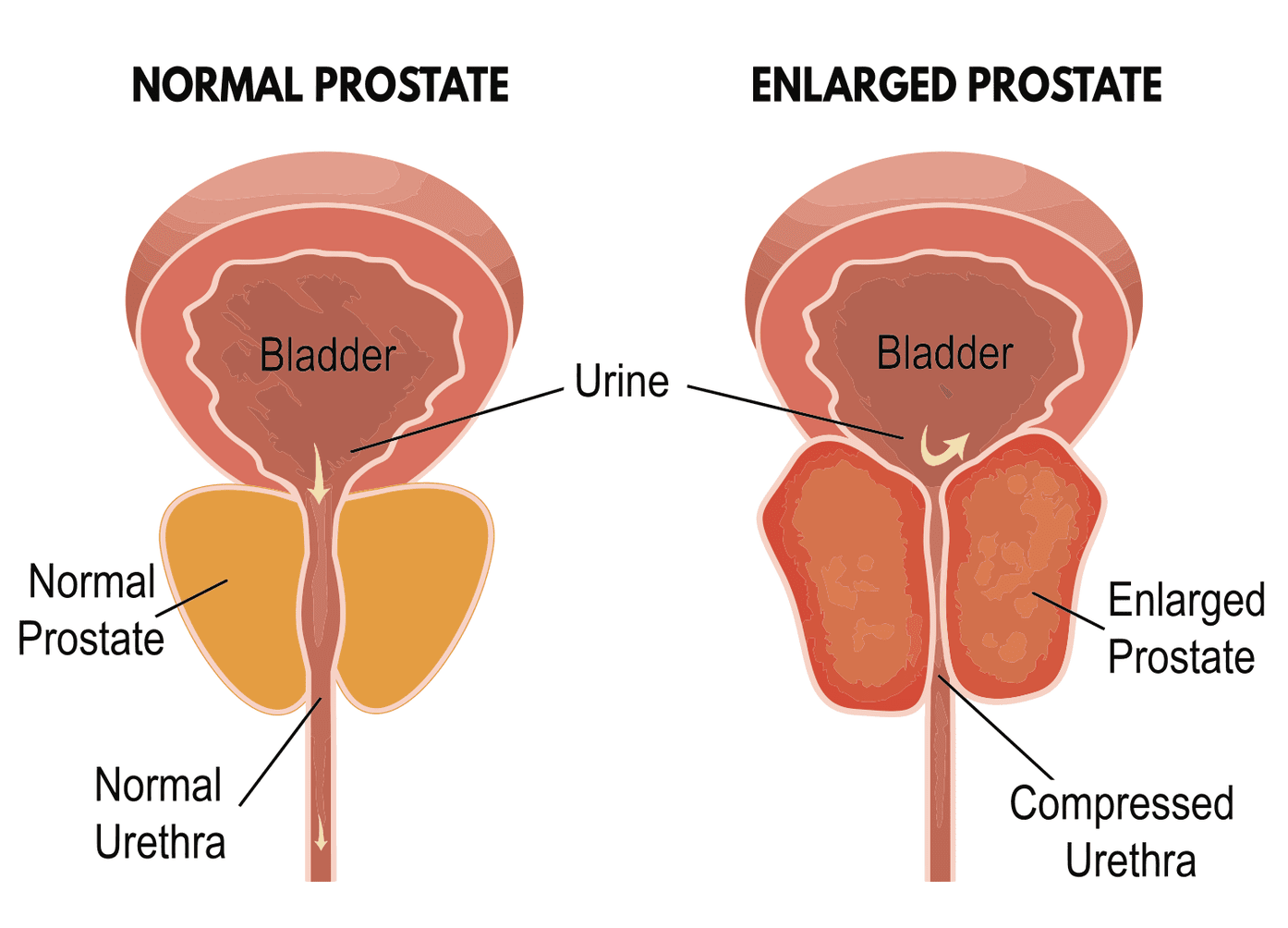 Healing Homeopathy Prostate Problems Common Sign Of Old Age In Males healing-homeopathy-prostate-problems-common-sign-of-old-age-in-males