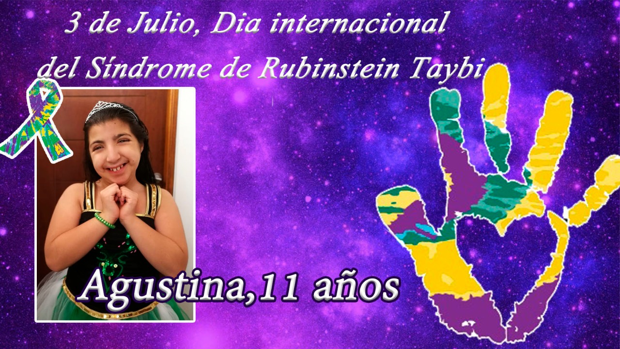 Día Mundial del Síndrome de Rubinstein Taybi