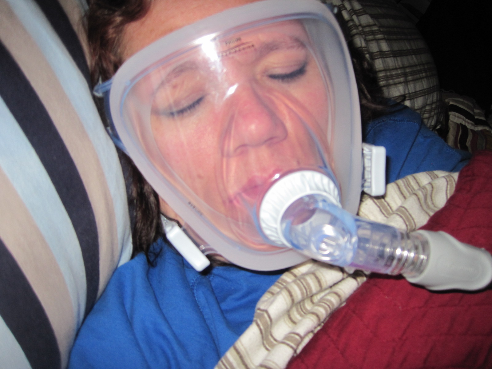 Life with Acromegaly Aaaah the joy of Cpap machines