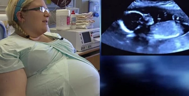 A woman gives birth to quadruplets