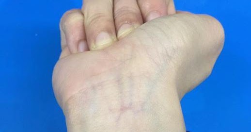 Nama Ubat Sakit Urat Di Farmasi Dralle Damen