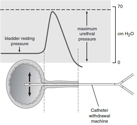 Urethral pressure profile