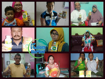 Obat Budug Buat Anak