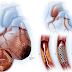 7 Unrevealed Silent Causes Of Heart Attacks