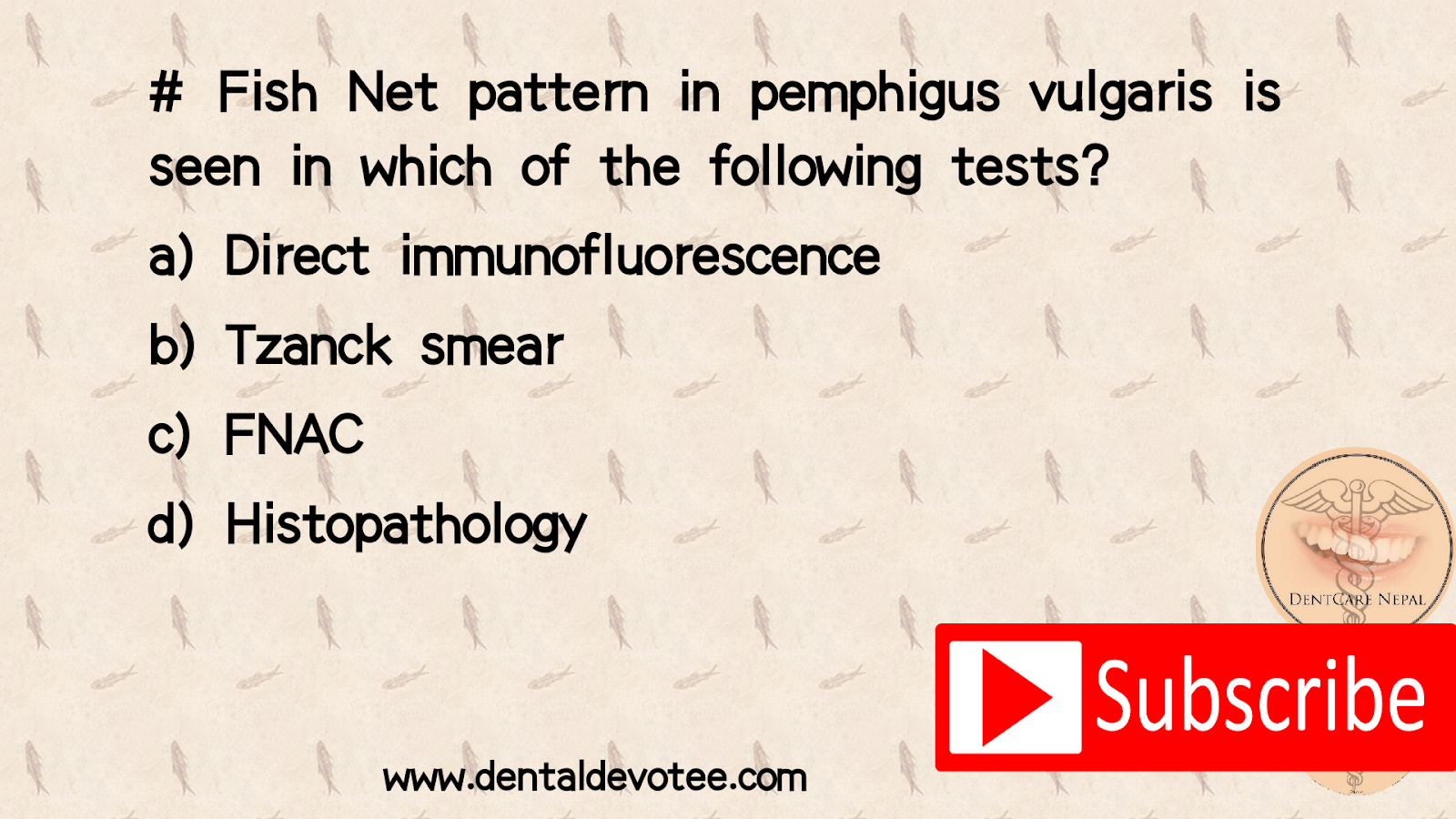 Dentosphere World of Dentistry Fish net pattern in Pemphigus Vulgaris