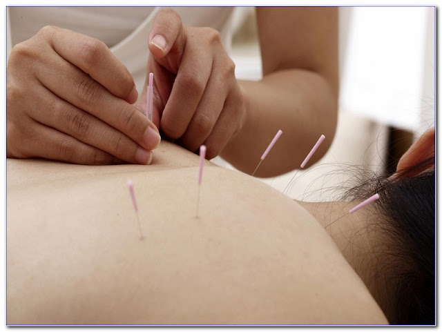 Best Acupuncture Training ONLINE COURSES Free