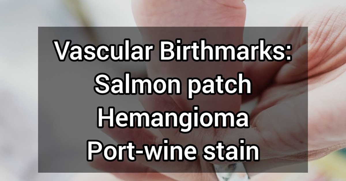 What are Vascular Birthmarks? Melody Jacob