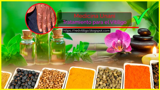 Vitiligo y su tratamiento con la Medicina Unani