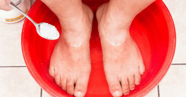 Cómo eliminar los hongos de los pies con bicarbonato