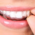 Saiba por que os dentes podem entortar mesmo após o uso do aparelho