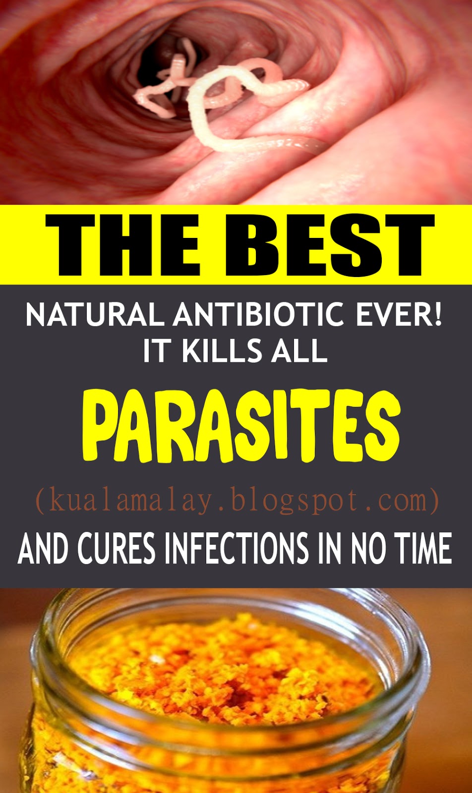 What Is The Best Antibiotic For A Bacterial Sinus Infection Get More Anythink's