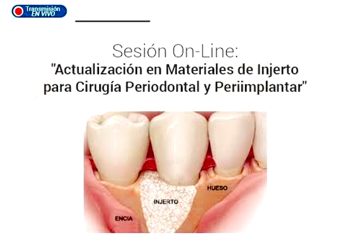 CIRUGÍA PERIODONTAL: Actualización en Materiales de Injerto Periodontal y Periimplantar - Dr. Alejandro Ordoñez