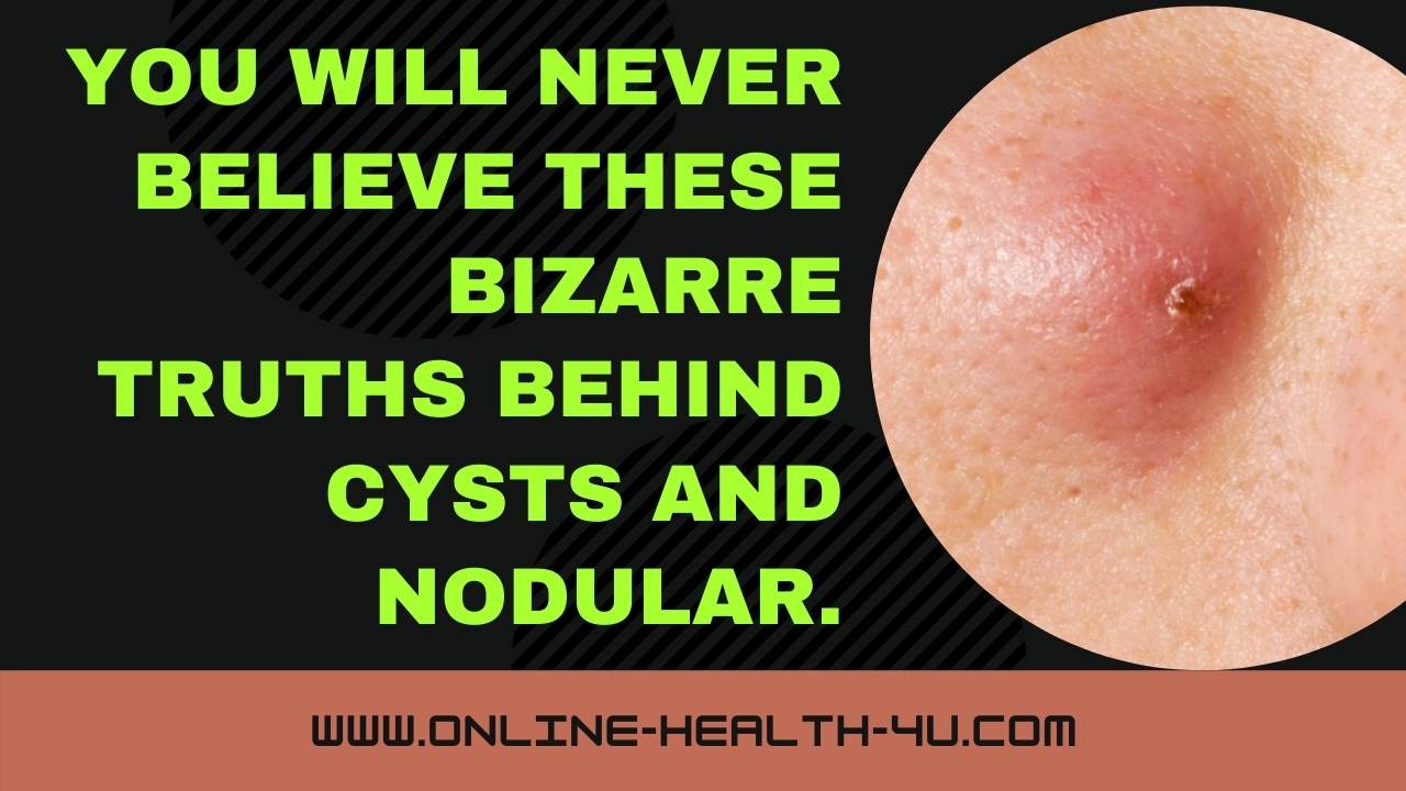 how-will-cysts-nodular-be-in-the-future