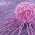 Καρκίνος μαστού: Νέα ανακάλυψη-κλειδί για την αποτροπή των μεταστάσεων