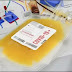 The Drug Regulatory Authority stopped plasma therapy of code 19