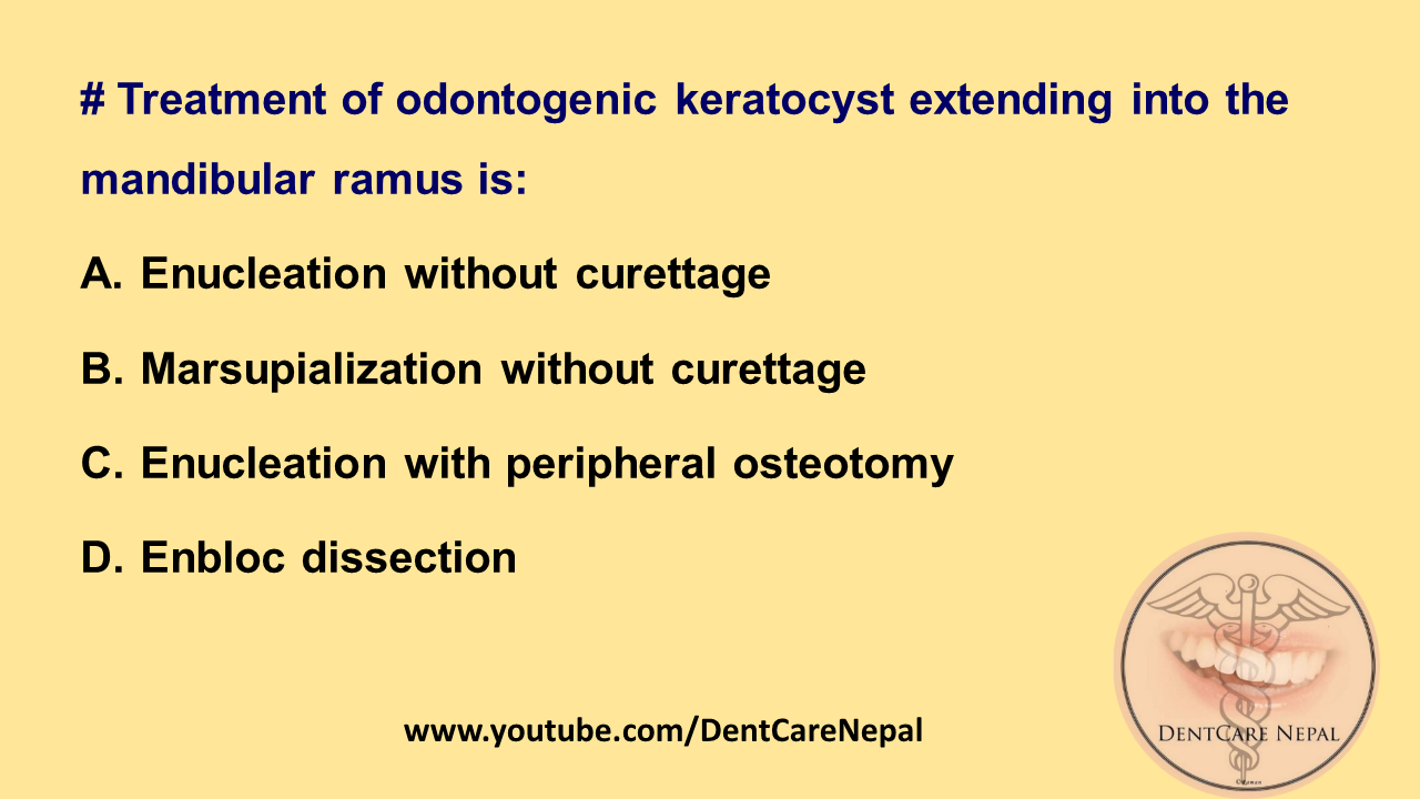 Dentosphere World of Dentistry Treatment of odontogenic keratocyst extending into the