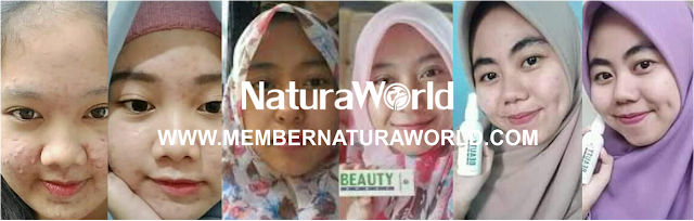 Testimoni Natura Beauty Spray Balita hingga Dewasa