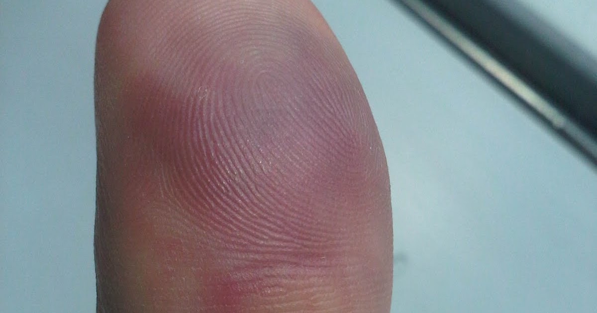 moriarty-s-musings-ode-to-my-left-thumb