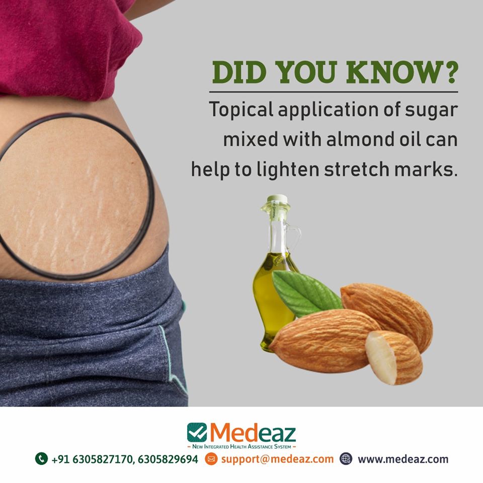 Almond Oil Can Help To Lighten Stretch Marks