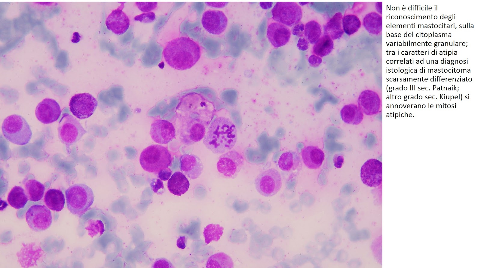 солитарная мастоцитома. цитология у кошек. лимфома у кошек цитология. криптококк цитология. мастоцитома цитология.