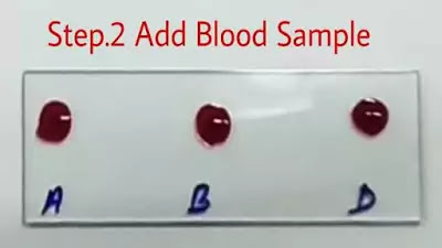 Blood group की जांच कैसे करें? | Blood group test in Hindi.