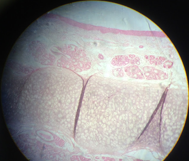 histology slide of elastic cartilage