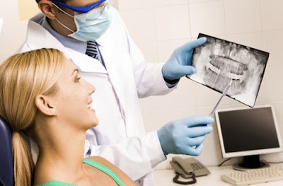 Cấy ghép răng implant có giá bao nhiêu?
