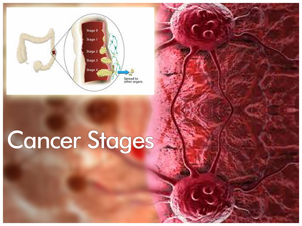 cancer-ppt-cancer-slides-cancer-symptoms-breast-cancer-lung-cancer