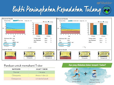 Siapa Yang Memerlukan Lebih Kalsium?