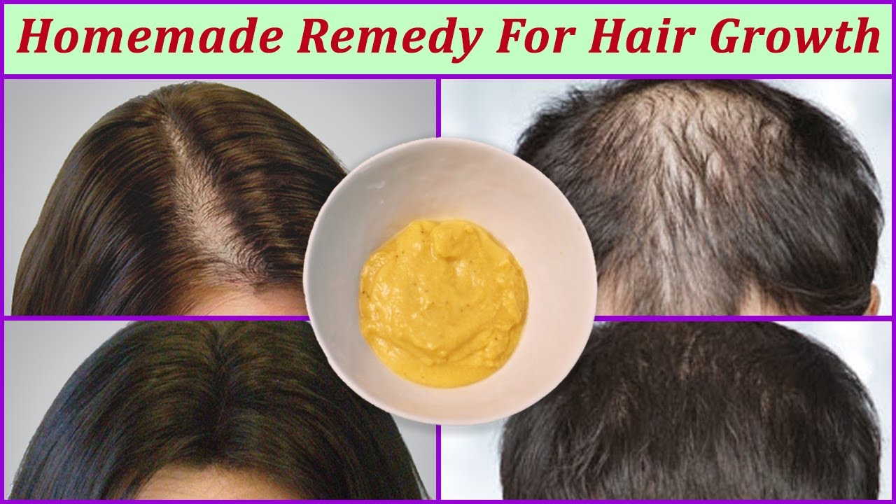 Homemade Remedy For Hair Growth - You Will Leave Everyone Speechless.
