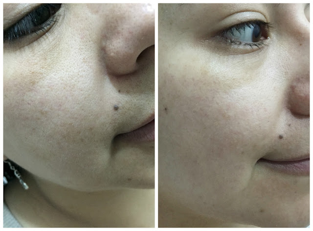 [Skin&Lab] Dr. Bio Infusion Bio Activating Essence | Korean Beauty Dream