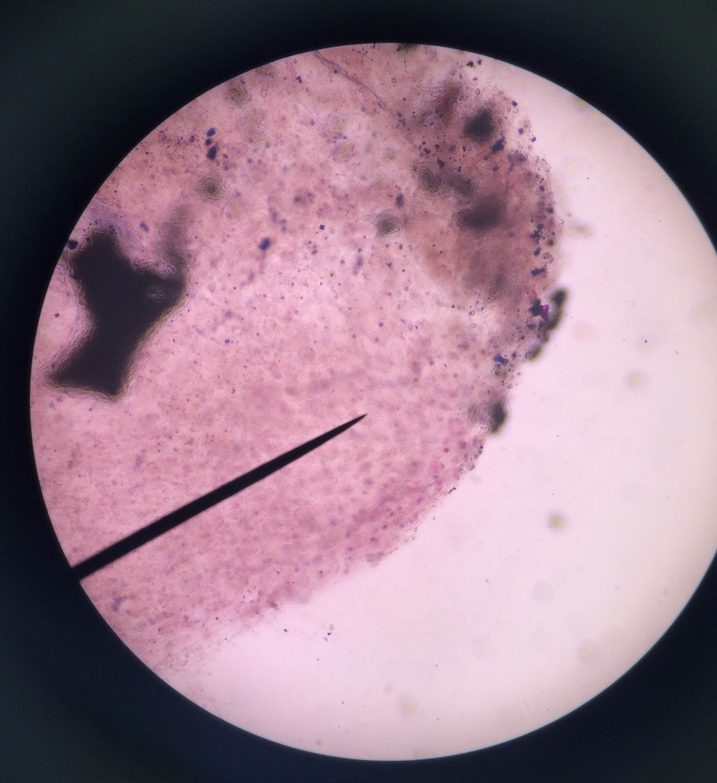 Phases Of Mitosis In An Onion Cell