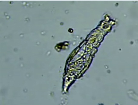 World Under Microscope