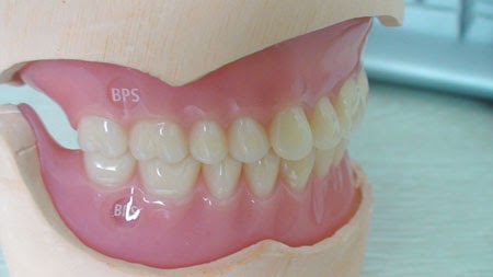 http://www.dentistinchennai.com/bps-denture.php