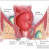 Obat Ambeien Kecil thumbnail