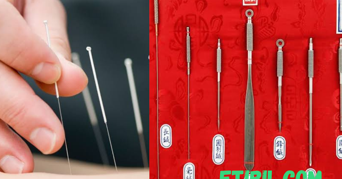 How Do You Tell the Difference Between Nine Types of Ancient