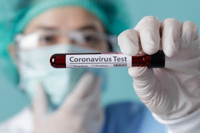 Swab Test Corona dari SehatQ Swab Test Corona dari SehatQ