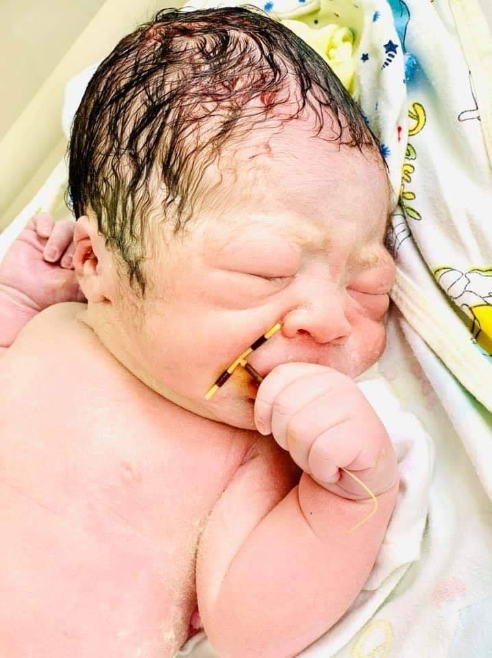 Photo of newborn baby holding an IUD moment he was born goes viral