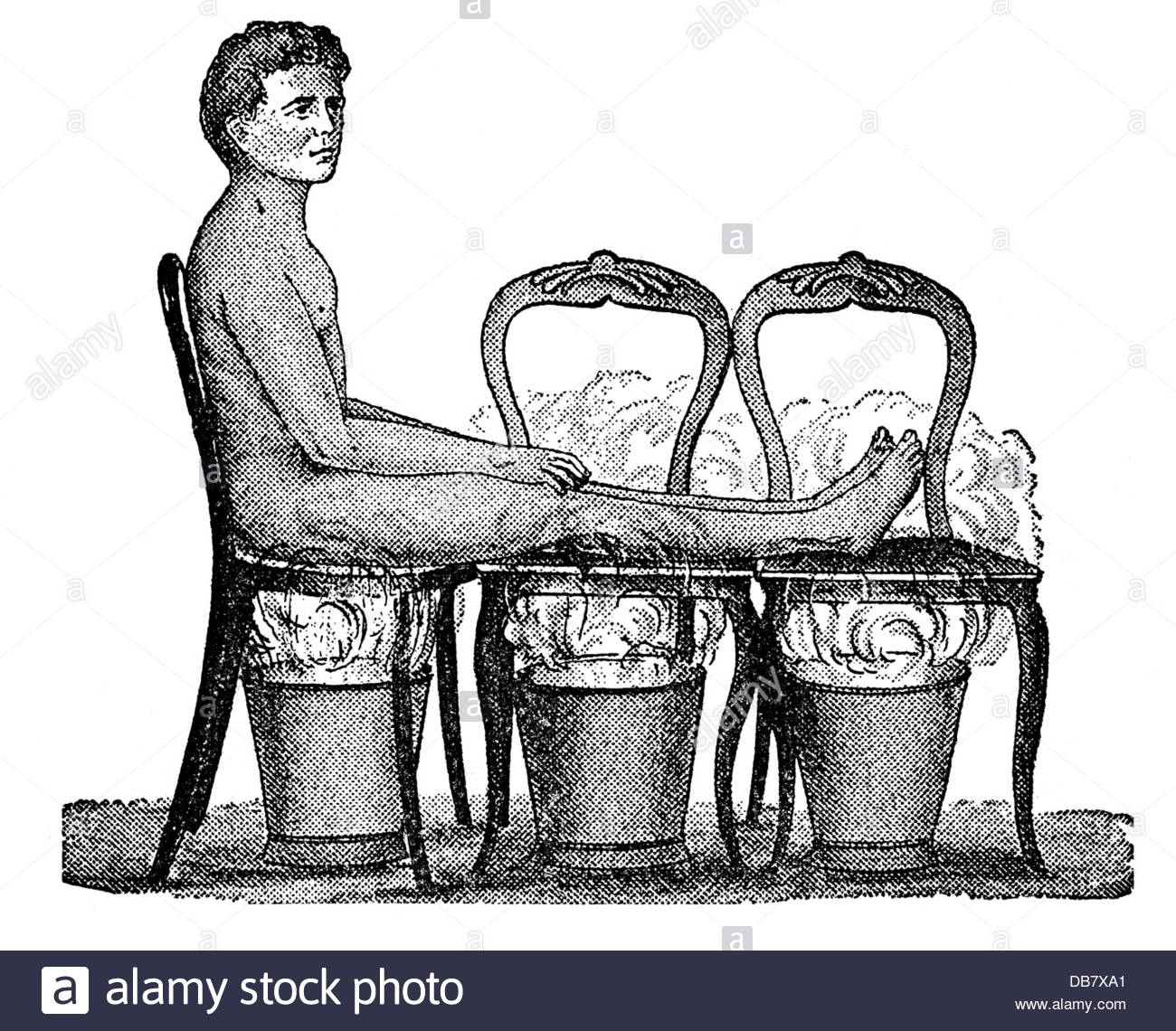 How to Take Steam Bath at Home Swami Dayanand Naturopathy Hospital