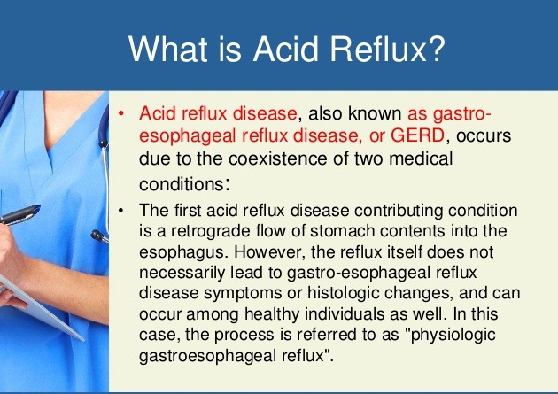 home remedies for acid reflux disease natural remedies for acid