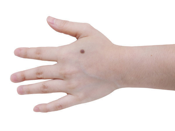 #23. Likewise, a nevi on the outside of the hand coincide with good management. - These Moles On Your Body May Reveal Secrets About Your Life. #23. Likewise, a nevi on the outside of the hand coincide with good management. - These Moles On Your Body May Reveal Secrets About Your Life.