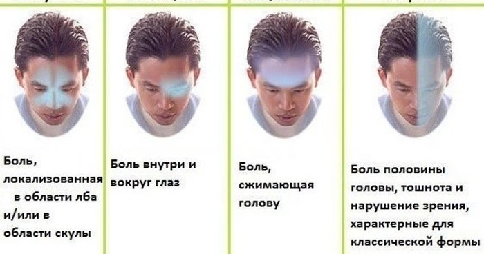 Головные боли напряжения схема Здоровье не купишь - его разум дарит!: Путеводитель по головной боли