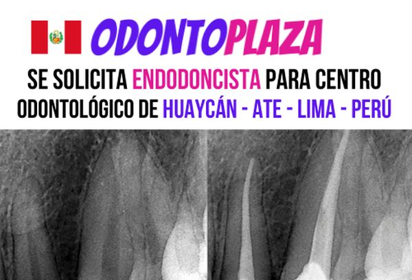 EMPLEO: Se solicita Endodoncista para Huaycán - Ate (Perú)