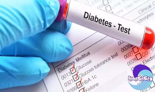 تحليل السكر - diabetes test
